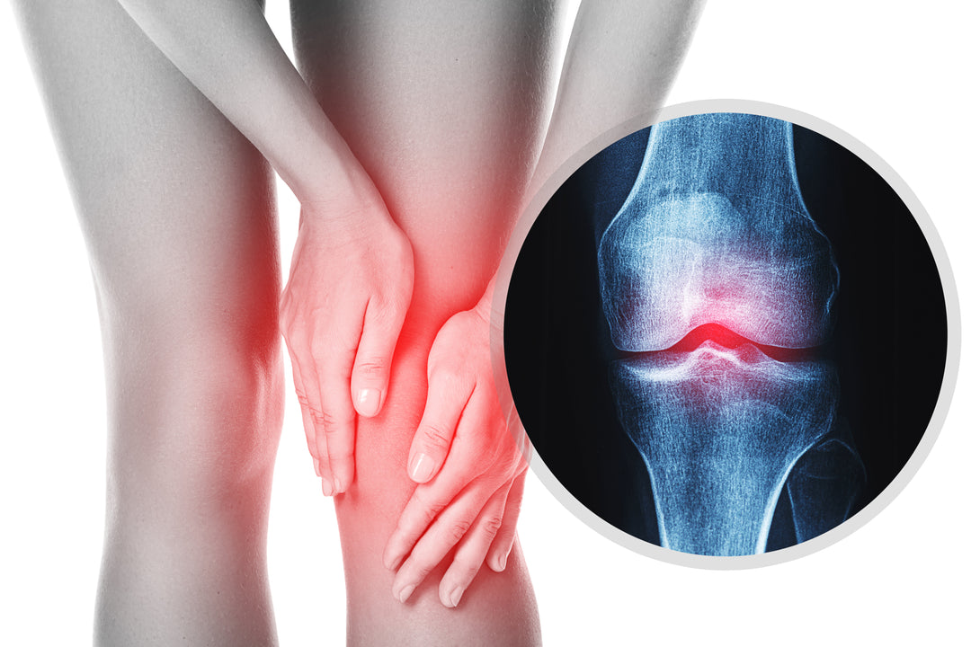 How Can I Improve My Joint Health?