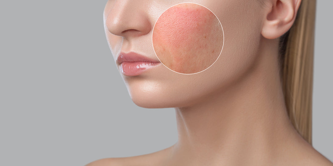What Are The Symptoms Of A Lack Of Collagen?
